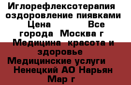 Иглорефлексотерапия, оздоровление пиявками › Цена ­ 3 000 - Все города, Москва г. Медицина, красота и здоровье » Медицинские услуги   . Ненецкий АО,Нарьян-Мар г.